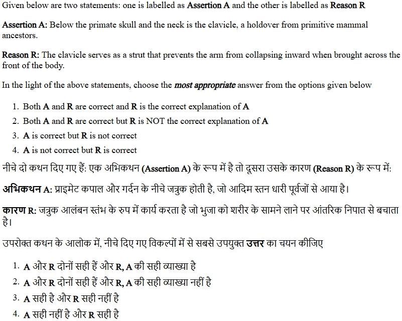 Read the question and choices in the excerpt. Choose A/B/C/D for the first/second/third/fourth option shown.